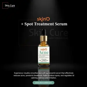 skinO Acne + Spot Treatment Serum-30ml